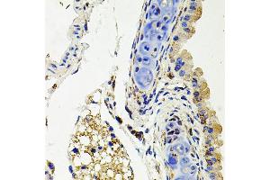 Immunohistochemistry of paraffin-embedded mouse lung using SDC2 antibody (ABIN3022587, ABIN3022588, ABIN3022589 and ABIN6218928) at dilution of 1:100 (40x lens). (Syndecan 2 抗体  (AA 19-144))