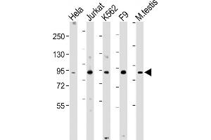 All lanes : Anti-NUP93 Antibody (N-Term) at 1:2000 dilution Lane 1: Hela whole cell lysate Lane 2: Jurkat whole cell lysate Lane 3: K562 whole cell lysate Lane 4: F9 whole cell lysate Lane 5: Mouse testis lysate Lysates/proteins at 20 μg per lane. (NUP93 抗体  (AA 20-54))
