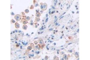 IHC-P analysis of Human Tissue, with DAB staining. (TCN2 抗体  (AA 19-427))