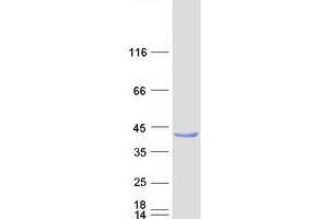Western Blotting (WB) image for Peptidylprolyl Isomerase (Cyclophilin)-Like 6 (PPIL6) (Transcript Variant 1) protein (Myc-DYKDDDDK Tag) (ABIN2729451)