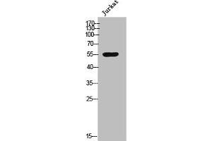 Western Blot analysis of Jurkat cells using Csk Polyclonal Antibody (CSK 抗体  (N-Term))