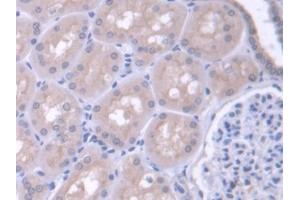 DAB staining on IHC-P; Samples: Human Kidney Tissue (FARS2 抗体  (AA 1-451))