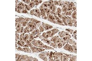 Immunohistochemical staining (Formalin-fixed paraffin-embedded sections) of human heart muscle shows strong granular positivity in myocytes. (NDUFB8 抗体)