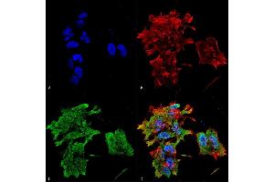 Immunocytochemistry/Immunofluorescence analysis using Mouse Anti-Alpha B Crystallin Monoclonal Antibody, Clone 3A10. (CRYAB 抗体  (FITC))