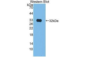 Western blot analysis of the recombinant protein. (Kallikrein 9 抗体  (AA 1-250))