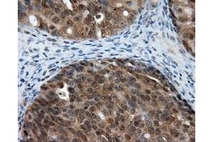 Immunohistochemical staining of paraffin-embedded Kidney tissue using anti-LIPG mouse monoclonal antibody. (LIPG 抗体)