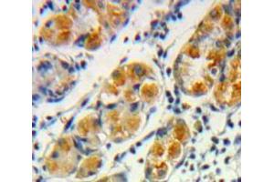 Used in DAB staining on fromalin fixed paraffin-embedded Stomach tissue (Frataxin 抗体  (AA 57-198))