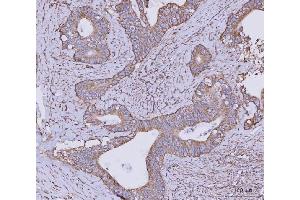 IHC analysis of CLASP1 using anti-CLASP1 antibody (ABIN7599144). (CLASP1 抗体  (AA 1-243))