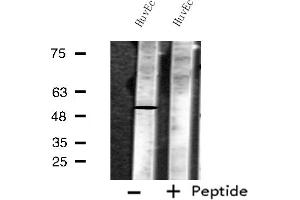 Western blot analysis of extracts from HuvEc cells, using MKNK1 antibody. (MKNK1 抗体  (Internal Region))