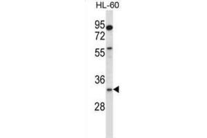 Western Blotting (WB) image for anti-Egl-9 Family Hypoxia Inducible Factor 3 (EGLN3) antibody (ABIN2997822) (EGLN3 抗体)