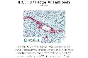 Image no. 1 for anti-Coagulation Factor VIII (F8) antibody (ABIN1723234) (Factor VIII 抗体)