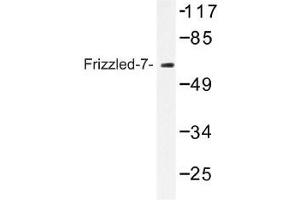 Image no. 1 for anti-Frizzled Family Receptor 7 (FZD7) antibody (ABIN317734) (FZD7 抗体)