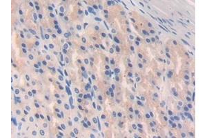 Immunohistochemistry (IHC) image for anti-Glutamate Decarboxylase 2 (Pancreatic Islets and Brain, 65kDa) (GAD2) (AA 188-374) antibody (ABIN7437707)