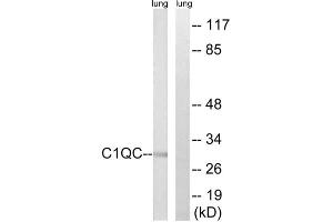 Western blot analysis of extracts from rat lung cells, using C1QC antibody. (C1QC 抗体  (Internal Region))