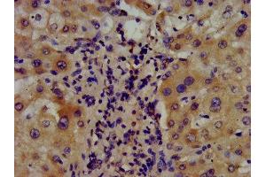 IHC image of ABIN7144688 diluted at 1:400 and staining in paraffin-embedded human liver tissue performed on a Leica BondTM system. (Arylsulfatase E 抗体  (AA 352-494))