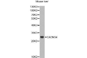 Western blot analysis of extracts of mouse liver, using CACNG4 antibody (ABIN2561527) at 1:1000 dilution. (CACNG4 抗体)