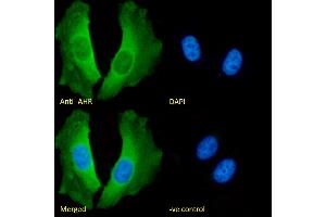 (ABIN5539467) Immunofluorescence analysis of paraformaldehyde fixed HeLa cells, permeabilized with 0. (Aryl Hydrocarbon Receptor 抗体  (Internal Region))