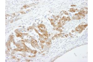 Immunohistochemistry (IHC) image for anti-Cellular Retinoic Acid Binding Protein 2 (CRABP2) (C-Term) antibody (ABIN7448487)