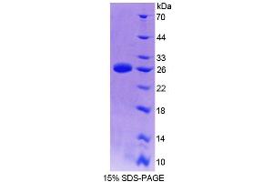 SDS-PAGE analysis of Mouse TMEM1 Protein. (TRAPPC10 蛋白)