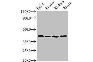 Western Blot Positive WB detected in: Hela whole cell lysate, Rat brain tissue, Mouse kidney tissue, Mouse brain tissue All lanes: ATAD1 antibody at 4 μg/mL Secondary Goat polyclonal to rabbit IgG at 1/50000 dilution Predicted band size: 41, 33 kDa Observed band size: 41 kDa (ATAD1 抗体  (AA 289-350))