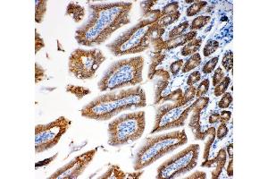 IHC analysis of EpCAM using anti-EpCAM antibody (ABIN7600081). (EpCAM 抗体  (AA 147-189))