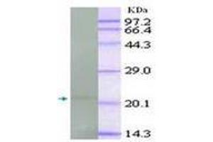 Image no. 1 for anti-Tumor Necrosis Factor alpha (TNF alpha) antibody (ABIN791557) (TNF alpha 抗体)