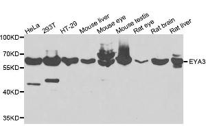 Western blot analysis of extracts of various cells, using EYA3 antibody. (EYA3 抗体)