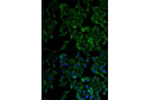 Immunofluorescence analysis of HeLa cell using TNFRSF1A antibody. (TNFRSF1A 抗体)