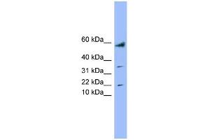 WB Suggested Anti-LYRM1 Antibody Titration: 0. (LYRM1 抗体  (Middle Region))