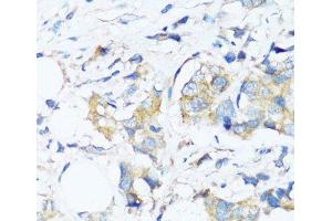 Immunohistochemistry (Paraffin-embedded Sections) (IHC (p)) image for anti-BCL2-Associated Athanogene 3 (BAG3) antibody (ABIN7258158)