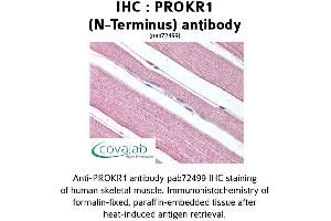 Image no. 1 for anti-Prokineticin Receptor 1 (PROKR1) (Extracellular Domain), (N-Term) antibody (ABIN1738398) (Prokineticin Receptor 1 抗体  (Extracellular Domain, N-Term))