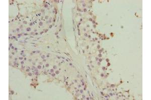 Immunohistochemistry of paraffin-embedded human testis tissue using ABIN7155901 at dilution of 1:100 (HORMAD2 抗体  (AA 14-307))