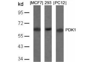 Image no. 4 for anti-3-phosphoinositide Dependent Protein Kinase-1 (PDPK1) (Ser241) antibody (ABIN197101) (PDPK1 抗体  (Ser241))