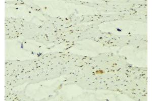 ABIN6277663 at 1/100 staining Mouse muscle tissue by IHC-P. (MAP1LC3A 抗体  (Internal Region))