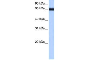 WB Suggested Anti-ZNF14 Antibody Titration:  0. (ZFP14 抗体  (N-Term))