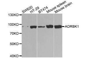 Western blot analysis of extracts of various cell lines, using ADRBK1 antibody. (GRK2 抗体  (AA 440-689))