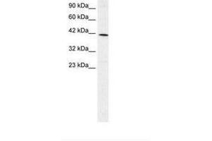 Image no. 2 for anti-Forkhead Box F2 (FOXF2) (AA 52-101) antibody (ABIN202540) (FOXF2 抗体  (AA 52-101))