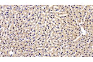Detection of LEPR in Mouse Liver Tissue using Polyclonal Antibody to Leptin Receptor (LEPR) (Leptin Receptor 抗体  (AA 22-203))