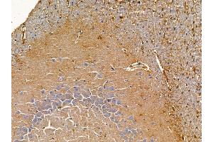 ABIN6265684 and ABIN6278747 at 1/100 staining rat brain tissue by IHC-P. (TPD52L1 抗体  (N-Term))