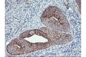 Image no. 1 for anti-Carboxypeptidase A2 (Pancreatic) (CPA2) antibody (ABIN1497596) (Carboxypeptidase A2 抗体)