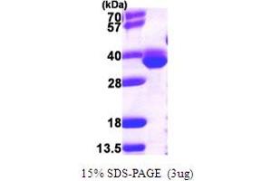 Methionine Aminopeptidase (AA 1-264) protein (His tag)