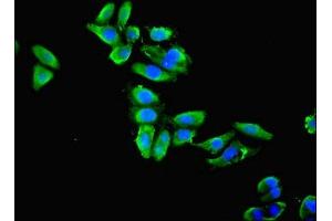 Immunofluorescence (IF) image for anti-Enolase 1 (ENO1) (AA 2-428) antibody (ABIN7143865)