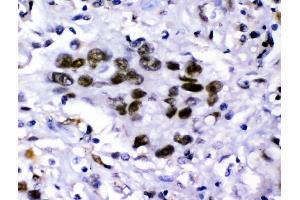IHC analysis of KDM5B using anti-KDM5B antibody (ABIN4886648).