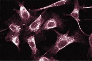 Immunofluorescent staining of Human Endothelial cells. (RAB5 抗体  (AA 1-215))