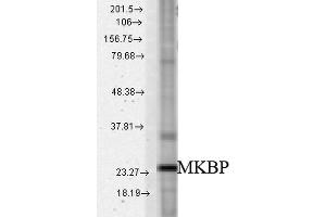 Western blot analysis of Rat tissue mix showing detection of HSPB2 protein using Rabbit Anti-HSPB2 Polyclonal Antibody .