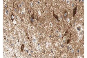 ABIN6267612 at 1/100 staining human brain tissue sections by IHC-P. (LIPE 抗体  (pSer552))
