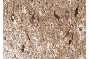 ABIN6267612 at 1/100 staining human brain tissue sections by IHC-P. (LIPE 抗体  (pSer552))