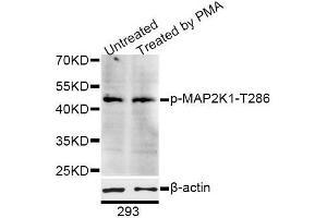 Western blot analysis of extracts of 293 cells, using Phospho-MAP2K1-T286 antibody (ABIN5995642) at 1/1000 dilution. (MEK1 抗体  (pThr285))