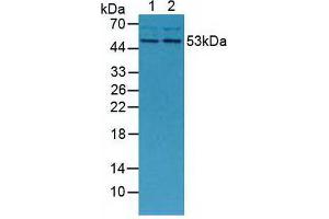 Western blot analysis of (1) Mouse Placenta Tissue and (2) Mouse Breast Tissue. (MMP13 抗体  (AA 66-238))