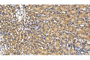 Detection of RIPK1 in Mouse Kidney Tissue using Polyclonal Antibody to Receptor Interacting Serine Threonine Kinase 1 (RIPK1)
